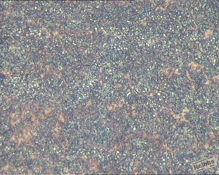 菜鸟问题gcr15淬回火后金相下碳化物是什么样的