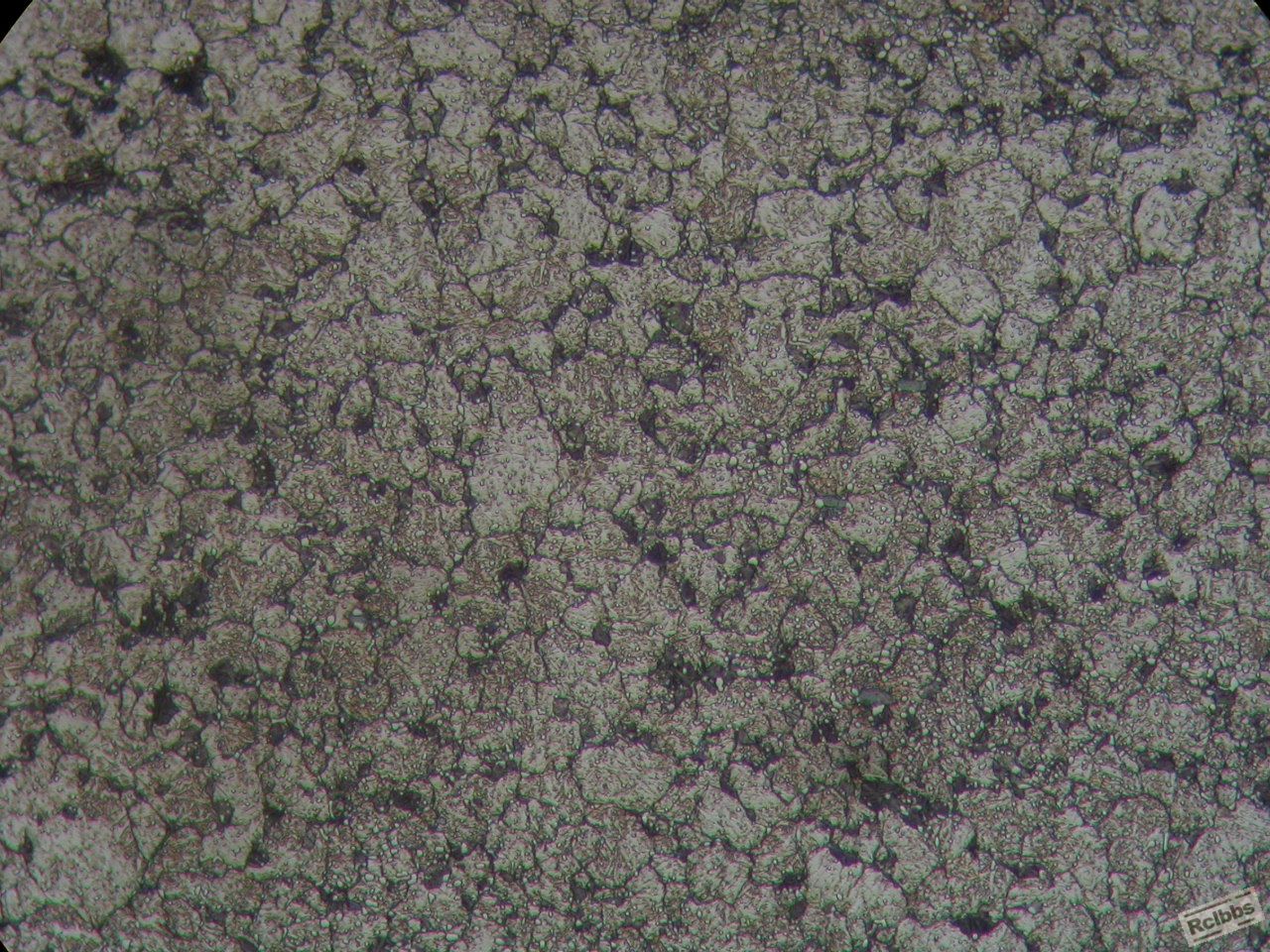 清晰的淬火屈氏体组织