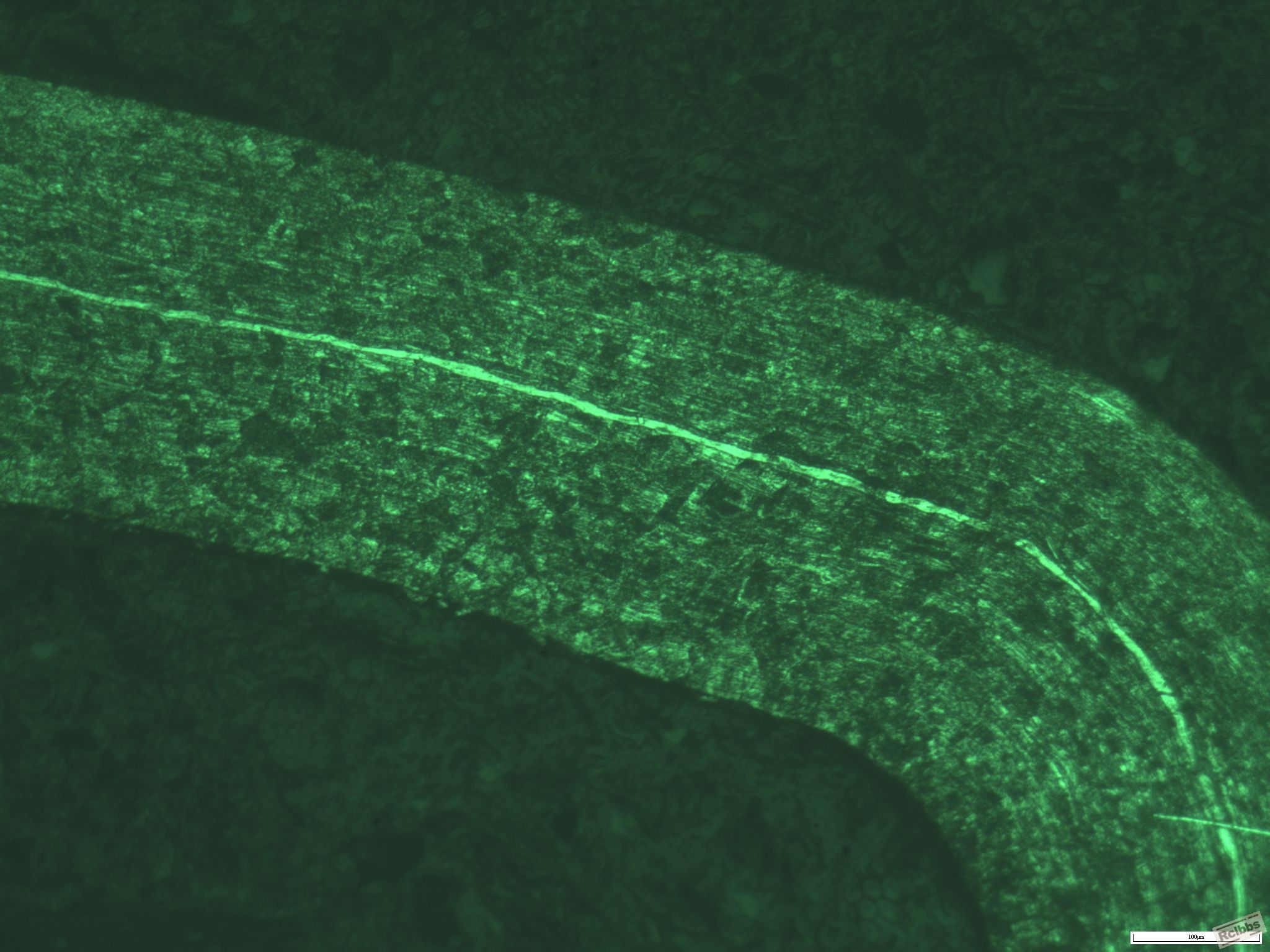 奥氏体不锈钢的组织.有图片.